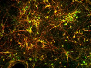 Cryopreserved Rat Cortical Neurons, 21DIV and immunostained with anti-PGP9.5 (green) and anti -Tubulin (red)